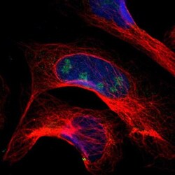 PITX1 Antibody, Novus Biologicals 0.1mL; Unlabeled:Antibodies, Polyclonal